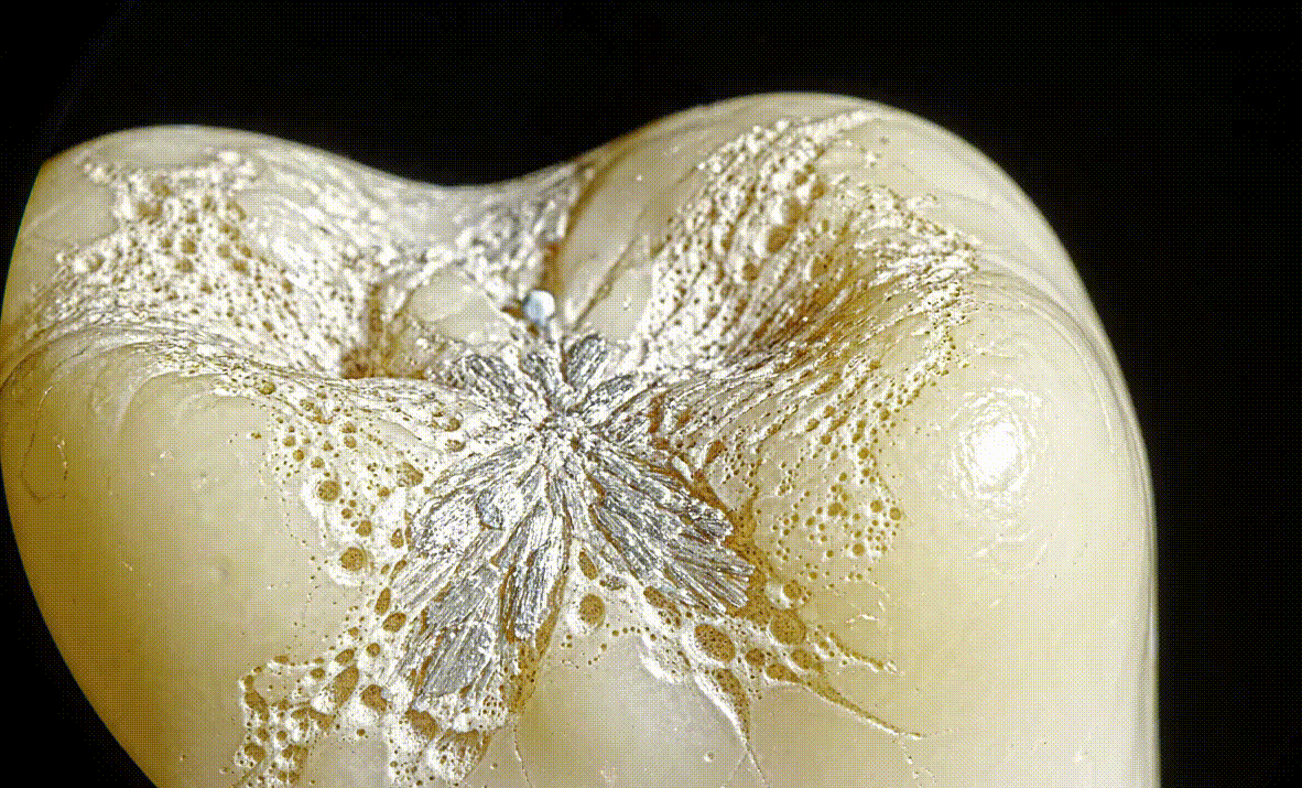 Hydroxyapatite mineral rebuilding tooth enamel at the microscopic level