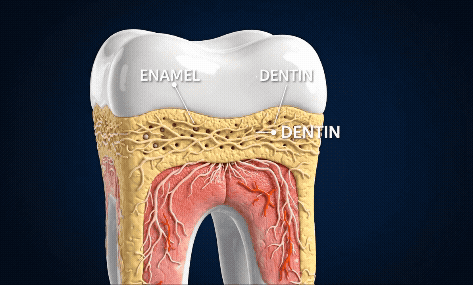 Tooth anatomy showing enamel and dentin layers